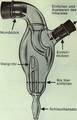 Schematic diagram of the Wolfer inhaler in the instructions for use